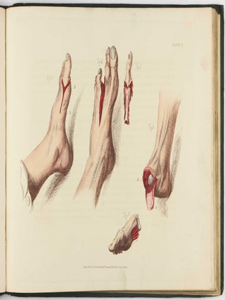 Illustrations of the Great Operations of Surgery, Trepan, Hernia, Amputation, Aneurism, and Lithotomy.