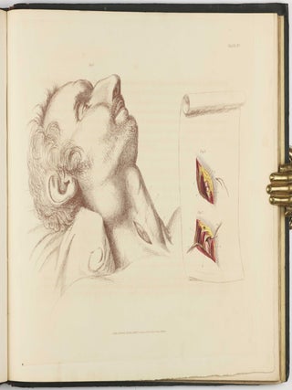 Illustrations of the Great Operations of Surgery, Trepan, Hernia, Amputation, Aneurism, and Lithotomy.
