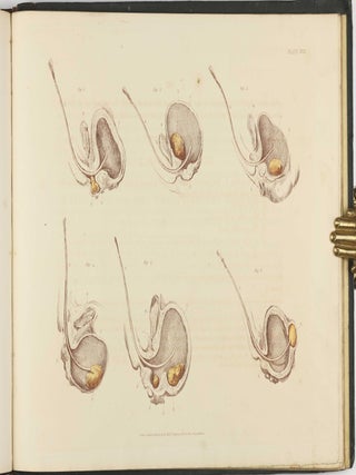 Illustrations of the Great Operations of Surgery, Trepan, Hernia, Amputation, Aneurism, and Lithotomy.