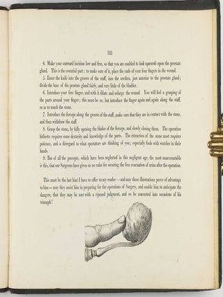 Illustrations of the Great Operations of Surgery, Trepan, Hernia, Amputation, Aneurism, and Lithotomy.