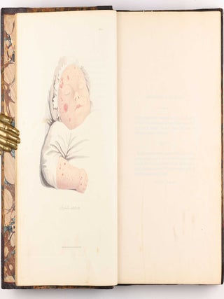 Delineations of Cutaneous Diseases, Exhibiting the Characteristic Appearances of the Principal Genera and Species Comprised in the Classification of the Late Doctor Willan, and Completing a Series of Engravings Begun by that Author, new edition.