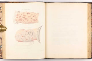 Delineations of Cutaneous Diseases, Exhibiting the Characteristic Appearances of the Principal Genera and Species Comprised in the Classification of the Late Doctor Willan, and Completing a Series of Engravings Begun by that Author, new edition.