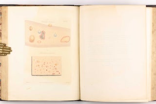 Delineations of Cutaneous Diseases, Exhibiting the Characteristic Appearances of the Principal Genera and Species Comprised in the Classification of the Late Doctor Willan, and Completing a Series of Engravings Begun by that Author, new edition.