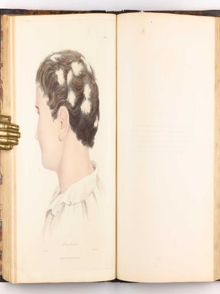 Delineations of Cutaneous Diseases, Exhibiting the Characteristic Appearances of the Principal Genera and Species Comprised in the Classification of the Late Doctor Willan, and Completing a Series of Engravings Begun by that Author, new edition.