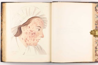 Delineations of Cutaneous Diseases, Exhibiting the Characteristic Appearances of the Principal Genera and Species Comprised in the Classification of the Late Doctor Willan, and Completing a Series of Engravings Begun by that Author, new edition.