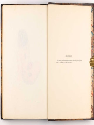 Delineations of Cutaneous Diseases, Exhibiting the Characteristic Appearances of the Principal Genera and Species Comprised in the Classification of the Late Doctor Willan, and Completing a Series of Engravings Begun by that Author, new edition.