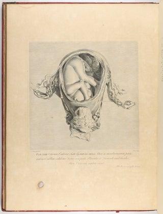 Anatomia uteri humani gravidi tabulis illustrata. The Anatomy of the Human Gravid Uterus exhibited in Figures.