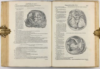 De humani corporis fabrica libri septem.