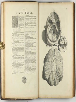 The Anatomy of Human Bodies, with Figures Drawn after the Life ... revised and publish'd by C. B. Albinus.