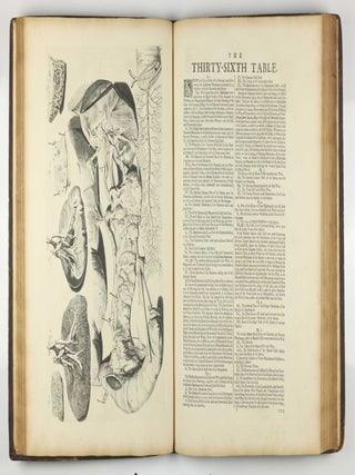 The Anatomy of Human Bodies, with Figures Drawn after the Life ... revised and publish'd by C. B. Albinus.