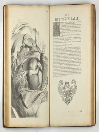 The Anatomy of Human Bodies, with Figures Drawn after the Life ... revised and publish'd by C. B. Albinus.