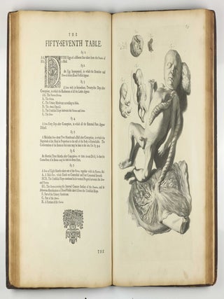 The Anatomy of Human Bodies, with Figures Drawn after the Life ... revised and publish'd by C. B. Albinus.