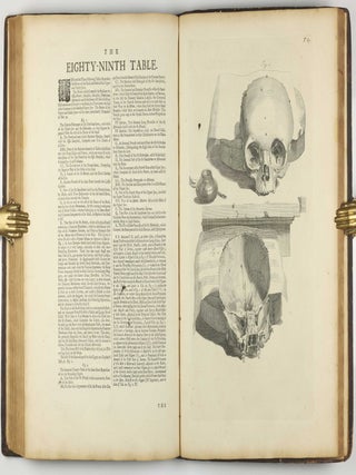 The Anatomy of Human Bodies, with Figures Drawn after the Life ... revised and publish'd by C. B. Albinus.