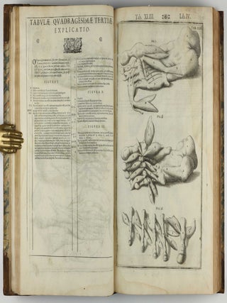 Tabulae anatomicae LXXIIX / De humani corporis fabrica libri decem. Edited by Daniel Bucretius / De formato foetu.