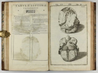 Tabulae anatomicae LXXIIX / De humani corporis fabrica libri decem. Edited by Daniel Bucretius / De formato foetu.