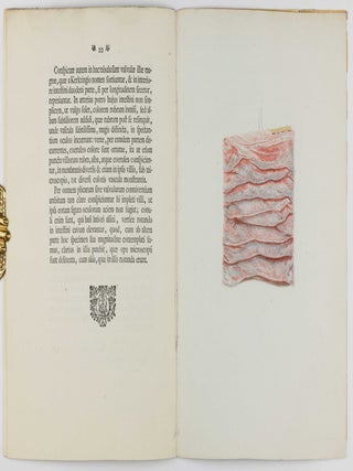Icon tunicae villosae intestini duodone, justa felicem vasculorum impletionem.