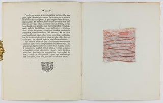 Icon tunicae villosae intestini duodone, justa felicem vasculorum impletionem.