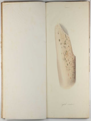 Traité des syphilides ou maladies vénériennes de la peau, precedee de considerations sur la syphilis, son origine, sa nature etc.