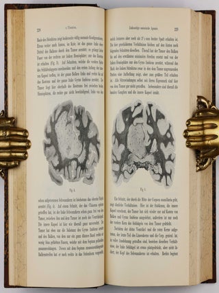 &Uuml;ber eine eigenartige Erkrankung der Hirnrinde. In: Allgemeine Zeitschrift f&uuml;r Psychiatrie und physisch-gerichtliche Medizin, Vol. 64, No 1, pp. 146-148.
