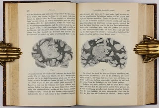 Über eine eigenartige Erkrankung der Hirnrinde. In: Allgemeine Zeitschrift für Psychiatrie und physisch-gerichtliche Medizin, Vol. 64, No 1, pp. 146-148.