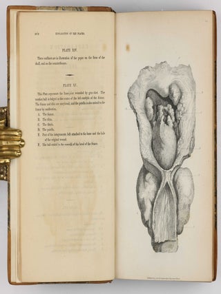 Surgical Observations, being a Quarterly Report of Cases in Surgery, treated in the Middlesex Hospital, in the cancer establishment, and in private practice: embracing an account of the anatomical and pathological researches in the School of Windmill Street.