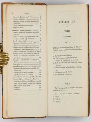 Surgical Observations, being a Quarterly Report of Cases in Surgery, treated in the Middlesex Hospital, in the cancer establishment, and in private practice: embracing an account of the anatomical and pathological researches in the School of Windmill Street.