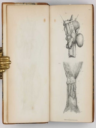 Surgical Observations, being a Quarterly Report of Cases in Surgery, treated in the Middlesex Hospital, in the cancer establishment, and in private practice: embracing an account of the anatomical and pathological researches in the School of Windmill Street.