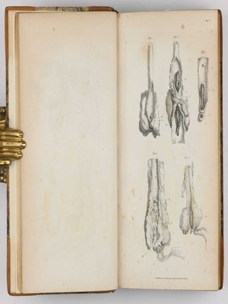 Surgical Observations, being a Quarterly Report of Cases in Surgery, treated in the Middlesex Hospital, in the cancer establishment, and in private practice: embracing an account of the anatomical and pathological researches in the School of Windmill Street.