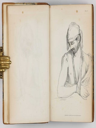 Surgical Observations, being a Quarterly Report of Cases in Surgery, treated in the Middlesex Hospital, in the cancer establishment, and in private practice: embracing an account of the anatomical and pathological researches in the School of Windmill Street.