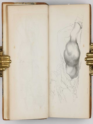Surgical Observations, being a Quarterly Report of Cases in Surgery, treated in the Middlesex Hospital, in the cancer establishment, and in private practice: embracing an account of the anatomical and pathological researches in the School of Windmill Street.