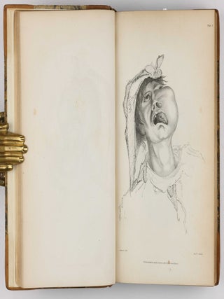 Surgical Observations, being a Quarterly Report of Cases in Surgery, treated in the Middlesex Hospital, in the cancer establishment, and in private practice: embracing an account of the anatomical and pathological researches in the School of Windmill Street.