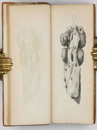 Surgical Observations, being a Quarterly Report of Cases in Surgery, treated in the Middlesex Hospital, in the cancer establishment, and in private practice: embracing an account of the anatomical and pathological researches in the School of Windmill Street.