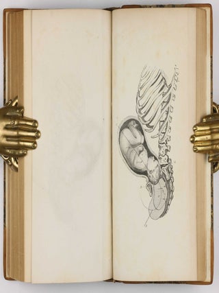 Surgical Observations, being a Quarterly Report of Cases in Surgery, treated in the Middlesex Hospital, in the cancer establishment, and in private practice: embracing an account of the anatomical and pathological researches in the School of Windmill Street.