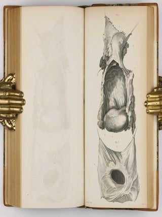 Surgical Observations, being a Quarterly Report of Cases in Surgery, treated in the Middlesex Hospital, in the cancer establishment, and in private practice: embracing an account of the anatomical and pathological researches in the School of Windmill Street.
