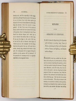 Surgical Observations, being a Quarterly Report of Cases in Surgery, treated in the Middlesex Hospital, in the cancer establishment, and in private practice: embracing an account of the anatomical and pathological researches in the School of Windmill Street.